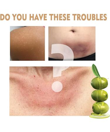 BOKIOESDE Women Body Brightening Whitening Serum Elbows Knees Armpit Moisturizing Hydrating Essence Skin Care - Buy Online on GoSupps.com