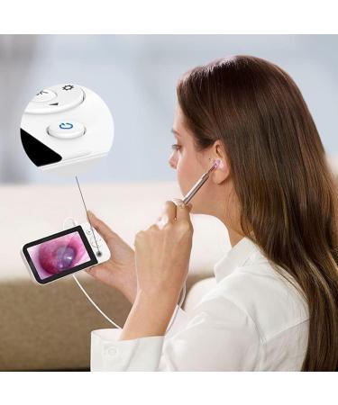 KouRy Ear Wax Removal Tool - HD 500MP Camera 6 LED Lights LCD Screen - Safe & Effective Ear Cleaner for Kids & Adults | International Shipping - Buy Online on GoSupps.com