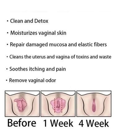 Bee Toxin Ginger Oil Capsules - Instant Anti-Itch Detox Products Firming Repair & Pink and Tender Natural Capsules Stay Clear & Fresh - Buy Online on GoSupps.com