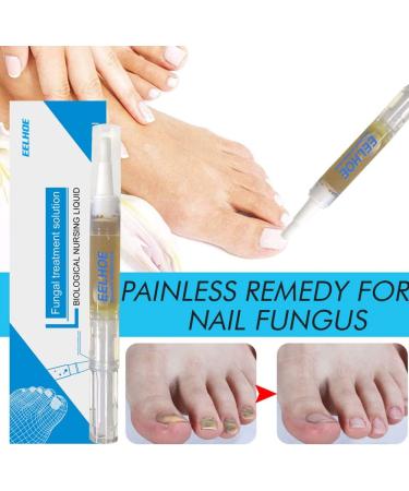 Okita Toenail Fungus Treatment Pen - Effective Nail Repair for Healthy and Strong Nails (5Pcs) - Buy Online on GoSupps.com