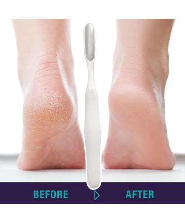 Foot Rasp Foot File Foot File Callus Remover Foot Scrubber - Shower Foot Scrubber Skin Removal Foot File Callus Remover Long Handled Toe Brush for Wet and Dry Feet White - Buy Online on GoSupps.com
