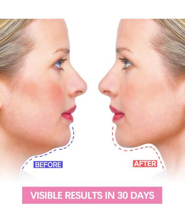 Double Chin Reducer & Face Slimming Strap | V Shaped Mask Eliminator for Women | Anti-Wrinkle Lifting Bandage & Skin Tightening Belt - Buy Online on GoSupps.com