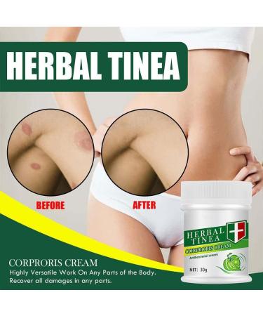 Zuicc Herbal Tinea Corporis Cream - Natural Itching Relief & Moisturizer for Tinea Dry Skin and Eczema Care - Buy Online on GoSupps.com
