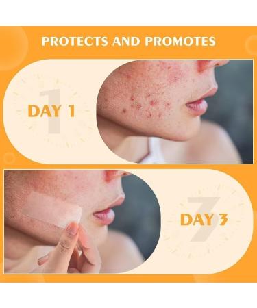 JOLVKA Large Blemish Patch 18 Strips (XL) Hydrocolloid Patches Spot Dots Zit Stickers for Face 18 Patches - Buy Online on GoSupps.com