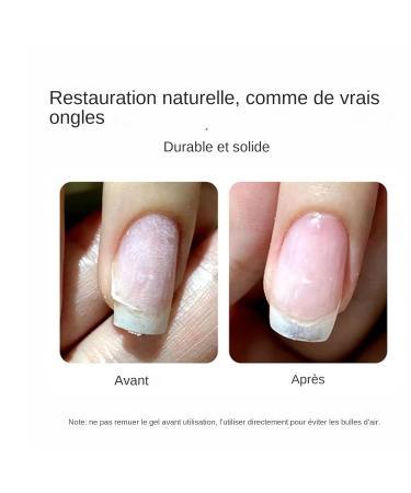 Pasbuteiy Broken Nail Repair Kit - 5g Gel Glue Brush Nail Clips Protective Repair Gel with File and Brush for Girls - Damaged Broken Split Nails - Daily Manicure Care - Daily Manicure - Buy Online on GoSupps.com