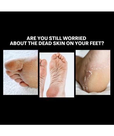 Nail Mill Bits Professional Foot Calluses Grinding Polishing Head Portable Pedicure Nail Drill Bit Remove Gel Acrylic Cuticle Nail File Bit for Manicure Pedicure(Medium fine sand) - Buy Online on GoSupps.com