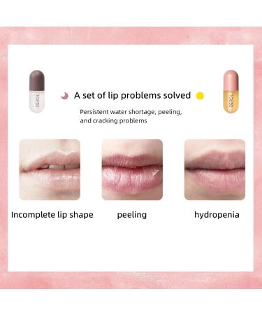 Lip Plumper Natural Lip Plumper Natural Lip Plumper and Lip Care Serum Double Effect Lip Plumper Lip Enhancer Lip Care Serum Lip Plumper Lip Enhancer Lip Plumper Set Lip Plumping Balm Lip Plumping Gloss Day Ues And Night Ues Set (2PCS) 1 count (Pack of 2) - Buy Online on GoSupps.com