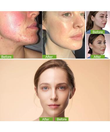 Mushroom Head Air Cushion BB Cream | Long-Lasting Nude Matte Concealer & Oil Control CC Cream | Moisturizing Foundation & Whitening Makeup for Flawless Skin - Buy Online on GoSupps.com