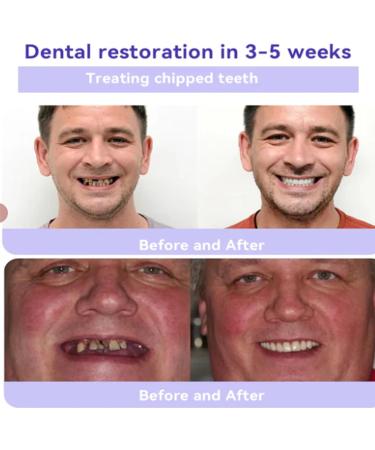 Oyikey Teeth Whitening Powder Teeth Restoration Mineral Powder Dental Mineral Powder Effective for Strengthening Teeth and Gums Teeth Restoration Mineral Powder (2) - Buy Online on GoSupps.com