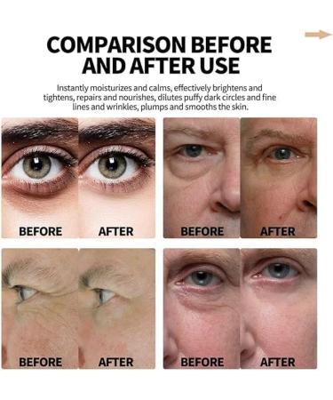 (100% Effective) 5PCS Time Eraser Rollerball Castor Oil and Frankincense | Time Eraser Rollerball for Eyes | Time Eraser Roller Ball Essential Oil for Eyes | Time Eraser | Under Eye Rollerball - Buy Online on GoSupps.com