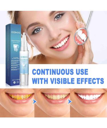 Teeth Whitening Abbey - Gums Therapy Gel & Tooth Elevator Essence Pen Set (3 PCs) - Instant Gum Treatment & Rejuvenation - Buy Online on GoSupps.com
