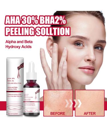 Buy Peeling Solution AHA 30% + BHA 2% Exfoliating Serum - Shrink Pores & Revitalize Skin | Fast International Shipping - Buy Online on GoSupps.com
