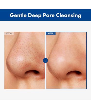 AHA Blackhead Out Cleansing Oil - Tea Tree & Jojoba Oil Makeup Remover | Gentle Korean Face Cleanser for Blackhead & Pore Removal 150ml - Buy Online on GoSupps.com