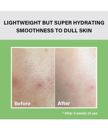 Celimax Noni Moisture Balancing Toner 150ml - Hydrating & Soothing with 80.1% Noni Extract - Anti-Aging Solution for Acne, Dark Spots, Fine Lines - Korean Skincare, Dermatologist Tested - Buy Online on GoSupps.com