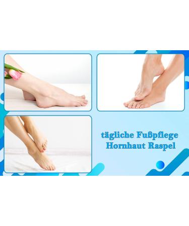 Effective Smi Foot Fish Remover for Calluses & Horny Skin - Ultimate Foot Care Solution - Buy Online on GoSupps.com