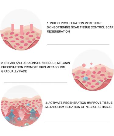 Silicone Scar Sheets - Surgical and Caesarean Scar Removal Tape for Men and Women - Buy Online on GoSupps.com
