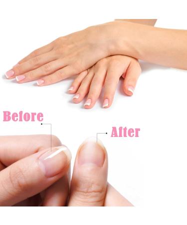 Cuticle Oil Pens for Nail Care Nail Nutrition Pen 2PCS Nail Revitalize Oil Pen Set for Nail Care Nail Oil Pens with Natural Ingredients Repairing - Buy Online on GoSupps.com