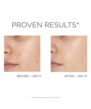 IDC Dermo Glowfix Peel Cotton Pads - Vegan Exfoliating Facial Rounds with Glycolic Acid - 60 Pads for Men & Women - International Shipping Available - Buy Online on GoSupps.com
