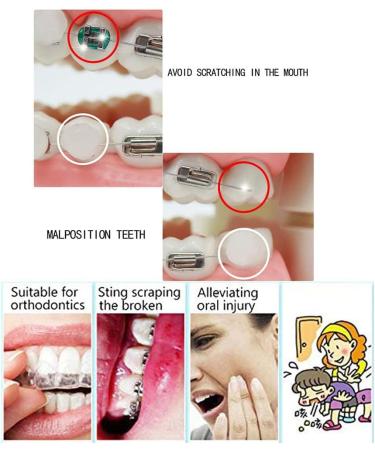 Chargenyang 6 Boxes Dental Oral Care Orthodontics Wax with Fruit Smell for Brace Wearers Flavored Gum Protection - Buy Online on GoSupps.com