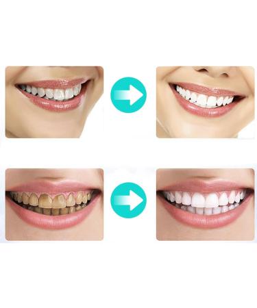 4Pcs Moldable Teeth Whitening Mouth Trays - Dental Oral Care Kit for Teeth Whitening, Bleaching, Grinding & Protection - Buy Online on GoSupps.com