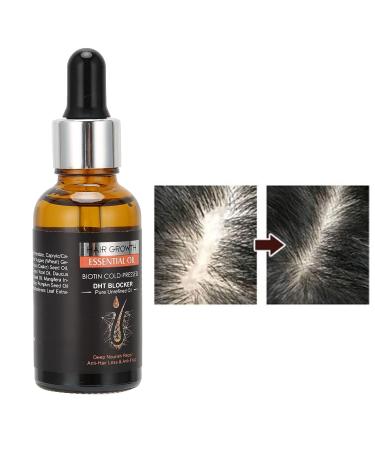 30ML Hair Growth Oil - Prevent Hair Loss Nourish Deeply Repair Follicles & Combat Frizz - Buy Online on GoSupps.com