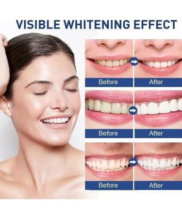 BAAQII Whitening Tooth Paint Tooth Whitening Essence Gel for Fast Teeth Cleaning and Polishing - Buy Online on GoSupps.com