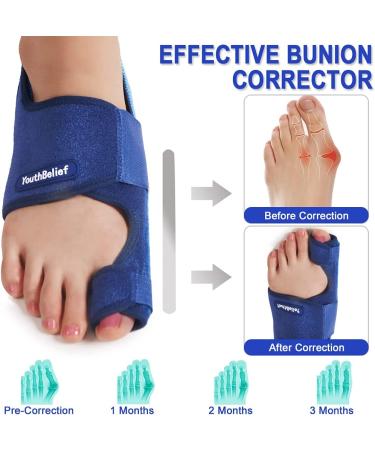 2022 Updated Toe Separator Bunion Corrector Set - Bunion Splint & Hallux Valgus Brace Kit for Bunion Pain Relief - Orthopedic Toe Alignment Tool with Free Blue Exercise Strap - Buy Online on GoSupps.com