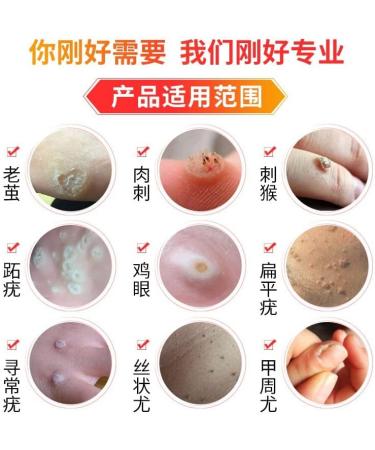 Ji yan Tie/Yat Tip Tor Corn & Callus Removing Plaster - 12 Plasters | Effective Corn & Callus Removal - Buy Online on GoSupps.com