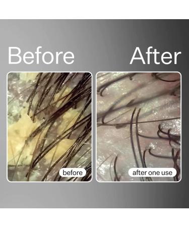 ACT+ ACRE Cold Processed Balancing Shampoo - Sulfate-Free Clarifying Hair Treatment with Moringa Oil (10 fl oz) - Buy Online on GoSupps.com