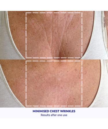 Wrinkles Schminkles Chest Wrinkle Patch & Cleanser Starter Pack - Reusable Silicone Patches to Smooth & Prevent D colletage Wrinkles - International Shipping Available - Buy Online on GoSupps.com
