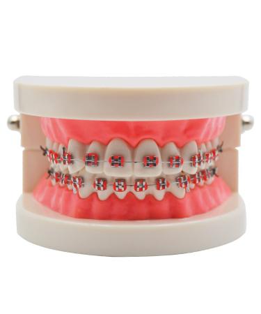 Standard Tooth Teaching Mallocclusion Orthodontic Teeth Model with Brackets Archwire Buccal Tube Tool