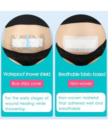 Breathable C-Section Wound Dressing - 4x10 Adhesive Bandages for Post-Surgery Recovery (Pack of 10 - Buy Online on GoSupps.com