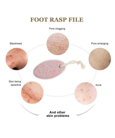 Minkissy Foot Peeling Pumice Stone - Natural 2-Piece Pedicure Tool for Dead Skin Removal - Pink Foot Care Essential - Buy Online on GoSupps.com