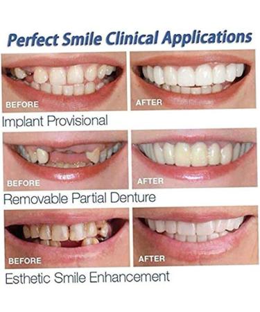 Buy 2 Pairs of Cosmetic Dentures - Instant Veneers & Temporary Teeth for Perfect Smile | Comfortable Fit - Buy Online on GoSupps.com