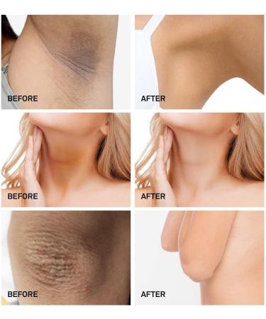 Whitening Cream Effectively Brightens Nourishes Repairs Armpit Elbows Knees Sensitive Areas - Buy Online on GoSupps.com