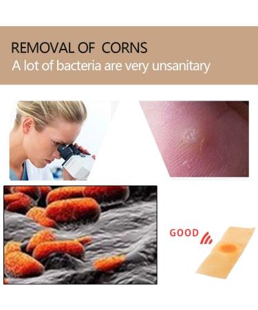 Wart Remover Corn Remover Foot Corn Remover Pads Plantar Wart Removal Corn Callus Remover Penetrates and Removes Common and Plantar Warts Callus Stops Wart Regrowth 20PC - Buy Online on GoSupps.com