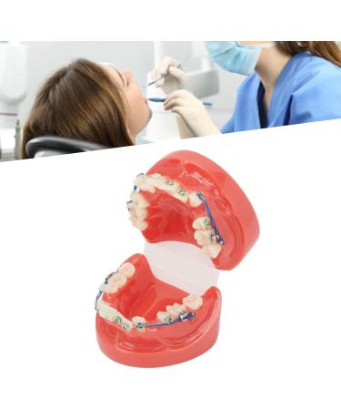 Buy Verdant Touch Metal Wires Tooth Model - 24 Teeth Semi-Metal Orthodontic Display | International Shipping Available - Buy Online on GoSupps.com