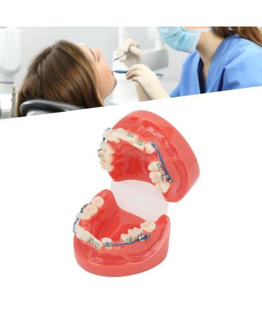 GFRGFH Dental Model Metal Wires 24 Teeth Half Metal Half Ceramic Bracket Tooth Correct Model For Study Teaching