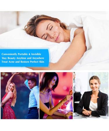 Acne Patch - 216 Invisible Hydrocolloid Patches for Effective Acne Relief | Suitable for All Skin Types - Buy Online on GoSupps.com