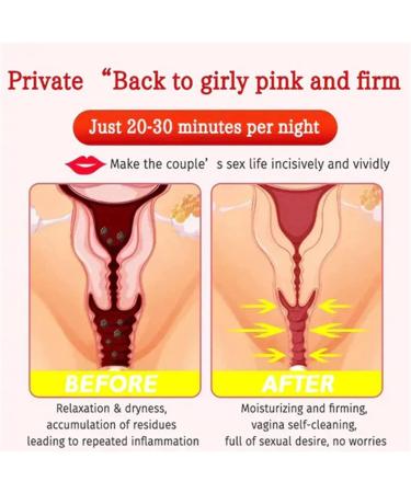 Dengwang Anniecare Natural Vaginal Repair Capsules and Detox Gel (Pack of 3 Boxes) - Buy Online on GoSupps.com