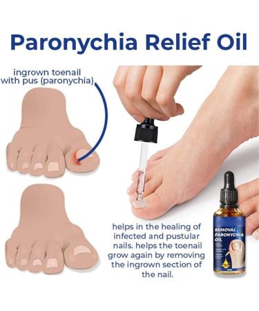German Toenailcare Removal Paronychia Oil Care Oil for Removing Paronychia Toenail Treatment Best Nail Repair Solution Nail Renewal Liquid for Damaged & Discoloration Nail (3pcs) - Buy Online on GoSupps.com