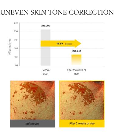 d'alba Piedmont White Truffle Vita Toning Serum Toner Glass Skin with Double Vitamin Skincare Face Moisturizer (6.09 fl. oz) - Buy Online on GoSupps.com