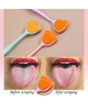 SHUAXI Tongue Brush and Scraper Set (4 Metal + 4 Plastic) for Adults and Kids - Helps Eliminate Bad Breath - Buy Online on GoSupps.com