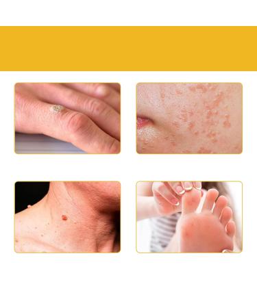 FROPUN Bee Venom Removal Cream - 100% Natural Fast-Acting Repair Cream for Adults - Maximum Strength Skin Care for Men & Women (1 Floz - Buy Online on GoSupps.com