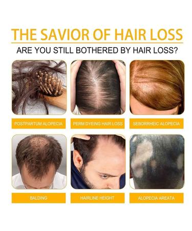 2023 New Allurium Hair Growth Serum for Black Women - Nourish, Repair, and Stimulate Fast Natural Hair Growth (3 Pcs) - Buy Online on GoSupps.com