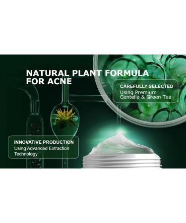 Azelaic Acid Face Cream for Acne Brightening & Skin Tone Correction | Oil Control Paraben-Free Cruelty-Free - Buy Online on GoSupps.com