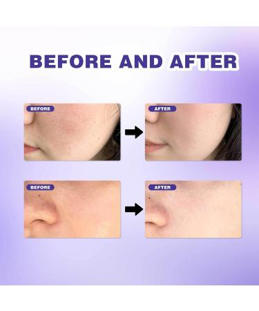 Pore refining serum facial serum reduces dark spots shrinks pores and improves skin tone the serum against excess oil the serum reduces pores - Buy Online on GoSupps.com