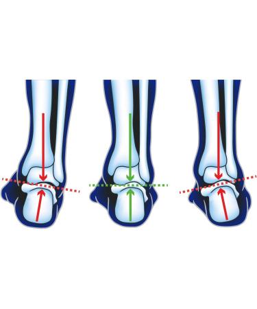 Advanced Cushion Plus Insole with F3D Foam 3mm Damper - Large | Anti-Shock Support for Supinators & High Arched Feet - Buy Online on GoSupps.com