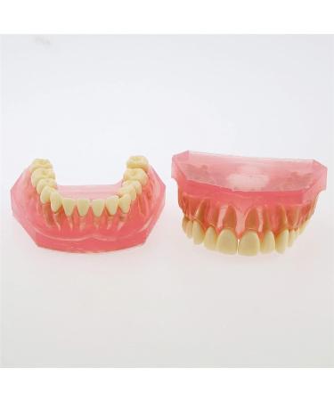 Nvivn Oral Implant Practice Model | Dental Training & Research Tool for Global eCommerce - Buy Online on GoSupps.com