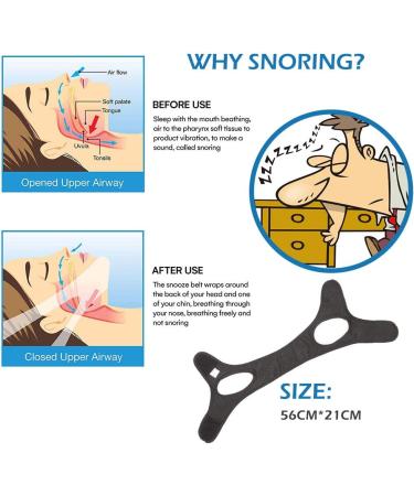 Anti Snoring Chin Strap - Adjustable, Comfortable, Professional Stop Snoring Device for Men, Women, and Kids - Black 1pc - Buy Online on GoSupps.com